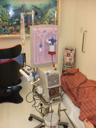 潰瘍性大腸炎に対する白血球除去療法の導入について